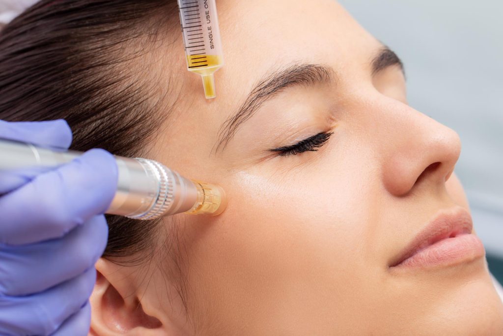 Microneedling - Réparation naturelle de l'épiderme - Électrocho avec micro-aiguilles et Luminothérapie